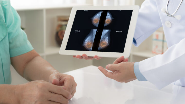 breast cancer breaststroke concept. doctor explain mammogram results of breast test from x-ray scan on digital tablet screen to patient.