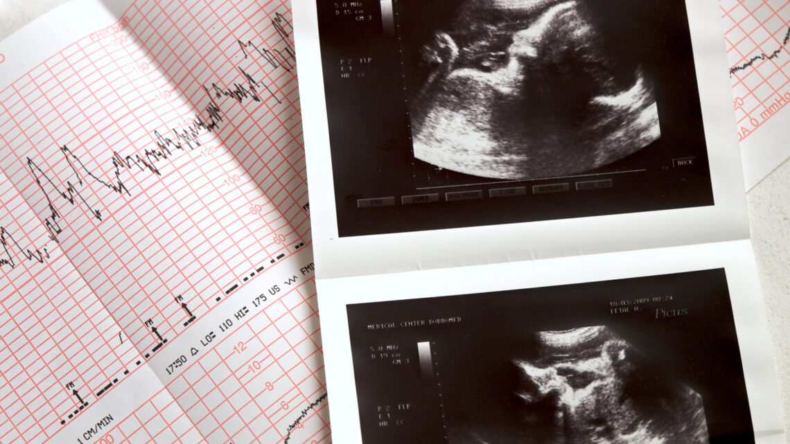 ultrasound portrait of the fetus and cardiogram results ,